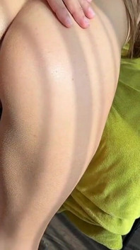 Anal Total