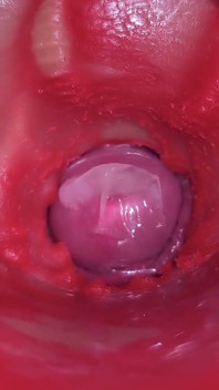 Camera Inside Pussy - Powerfull Cum in Pussy! Best Internal Asmr