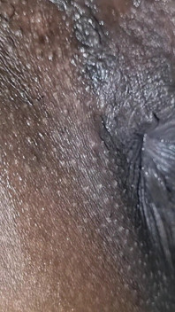 Anal