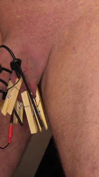 CBT pinnar och Estim