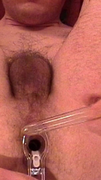 Masturbação com a mão do espéculo anal