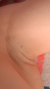 The Skin of My Armpits Is so Delicate