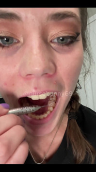 Sadistic Dental Cleaning