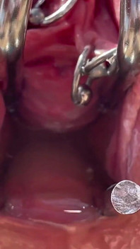 私の猫の中のおしっことSpeculum Outsid