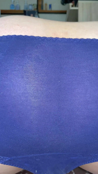 Kyotosigakk: En man avslöjar sitt rövhål Ta en närbild så att...