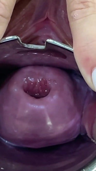 Glass Dildo Cervix Penetration