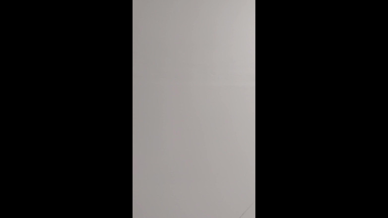 Albino Adonis: Hala çırılçıplak yürüyor