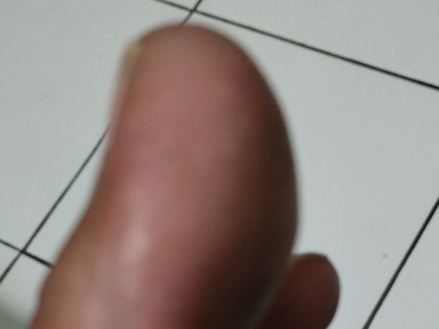 Test Toes (Bootbistd11)