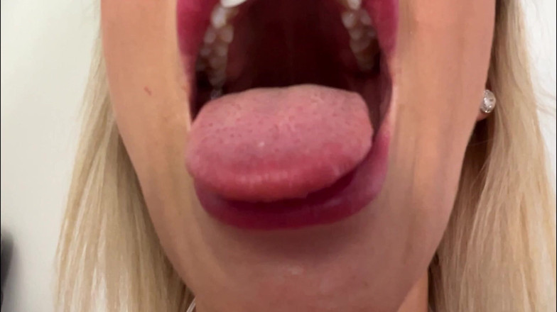 CALLIE ROKS: Inspeção oral de pvc