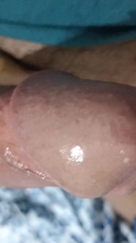 Estrecho Orificio Anal Provoca Derrame De Leche Muy Caliente