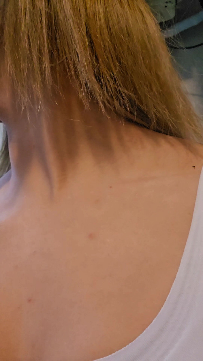 Young big apple: Amatorskie para jedzenia podczas transmisji na żywo