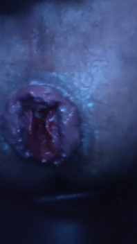 Playing with My Rosebud'd Pig Hole