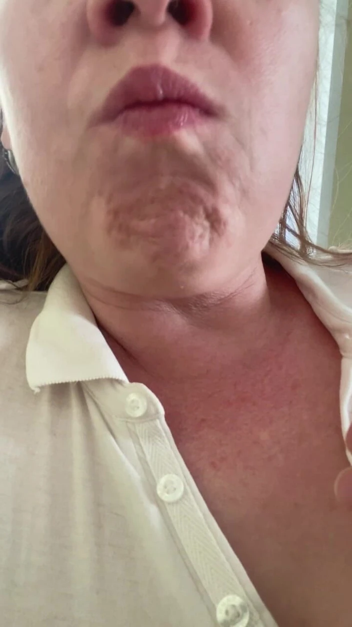 Hairy Labia