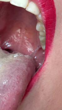 Uvula spit närbild förstapersonsvy