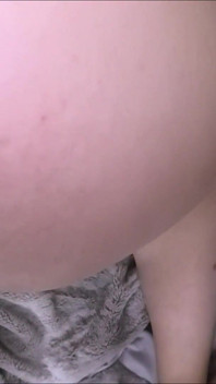 Pengecoran Anal