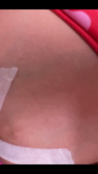 My Boob Is About to Explode