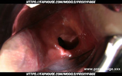 Proxypaige: Proxy Paige, plug de vidrio y espéculo Xo