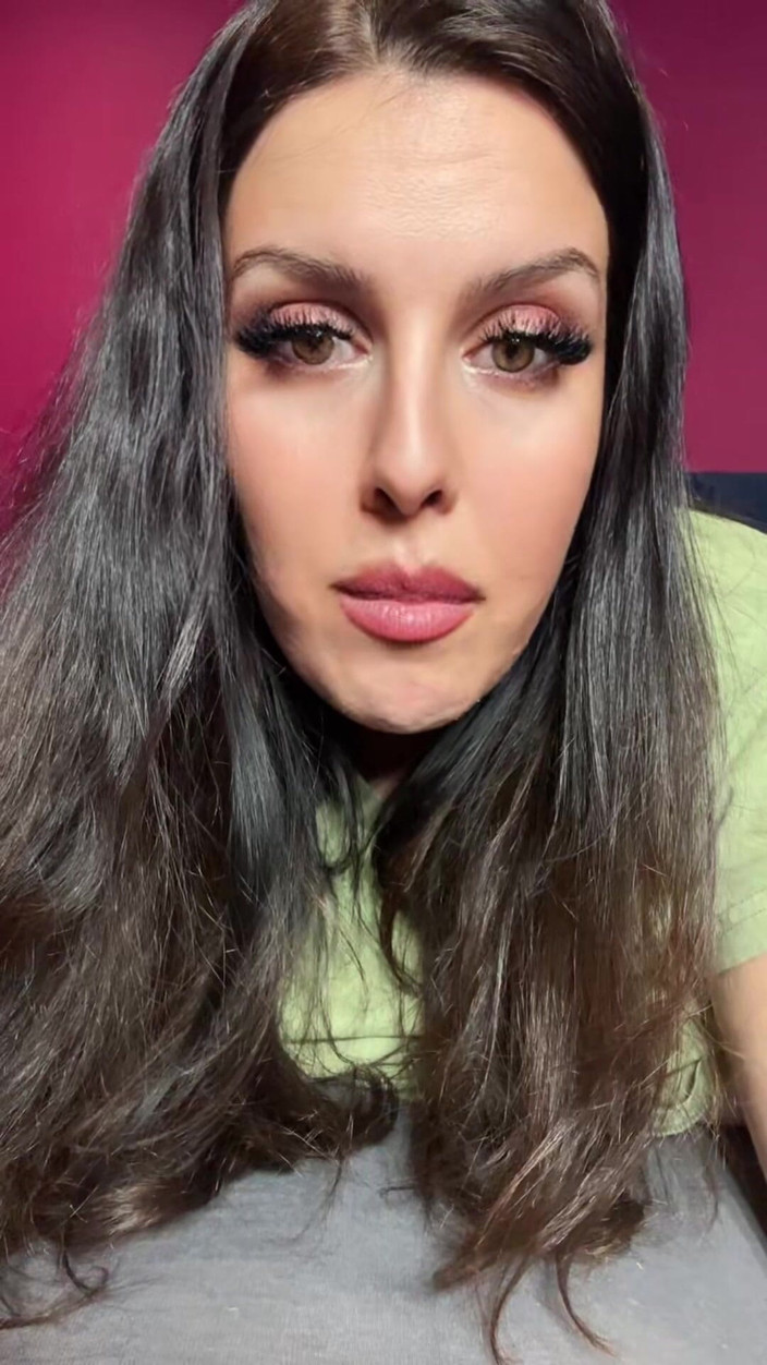Young_strawberry: Stepmommy Say:your Hand Is Hurt Let Stepmommy Jerkoff You