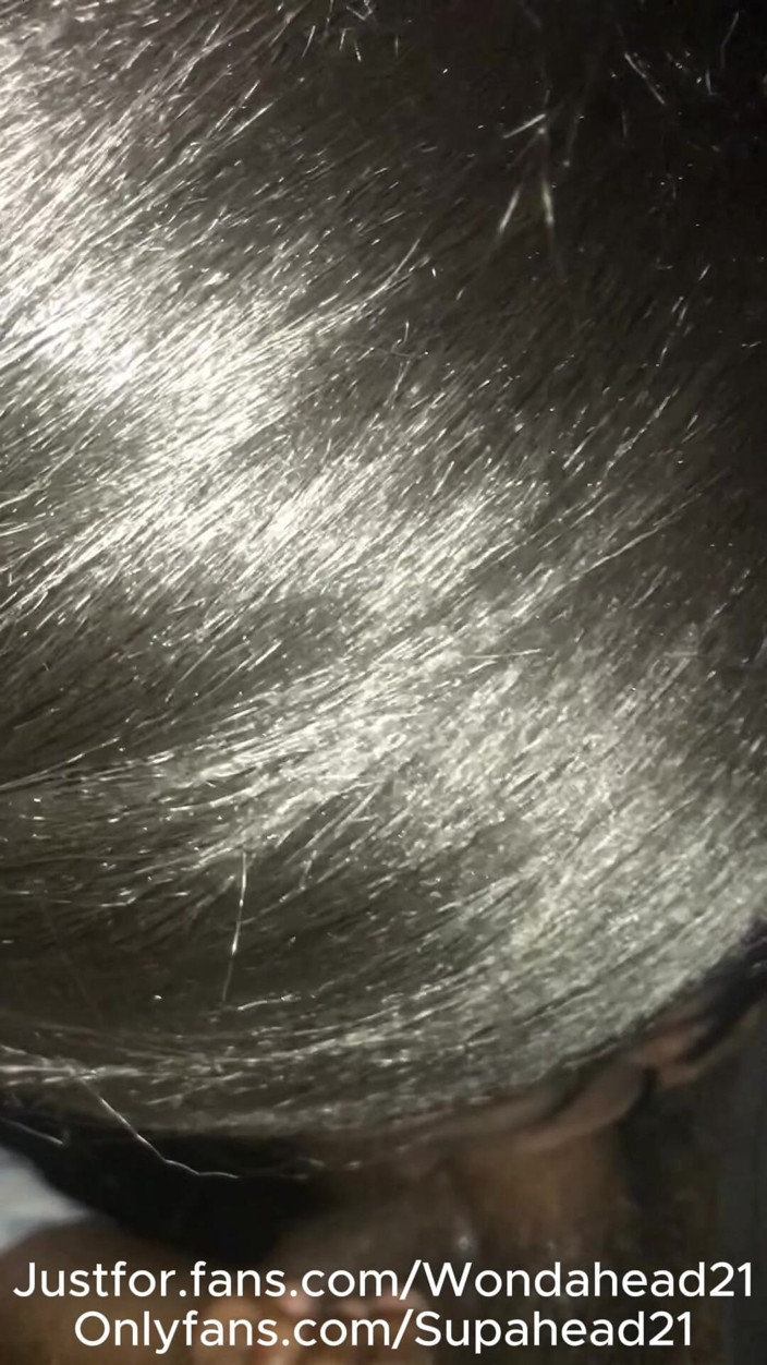 Wondahead21: Dva masivní ptáci jednu noc čokoládový rapper obchod a lehká kůže...