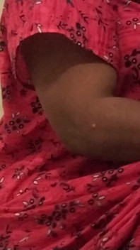 Hot Leg