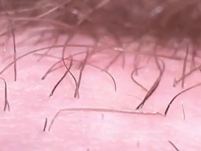 Macro Skin on My Dick (Nalekhome)