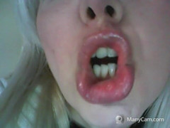 savannahamatoriale: Zeer lelijke tanden! Denti Orribili