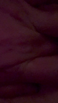 Scherzi anali