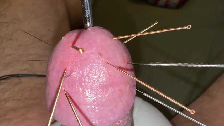 Acupuncture - Orgasm! (Buxte extreme)