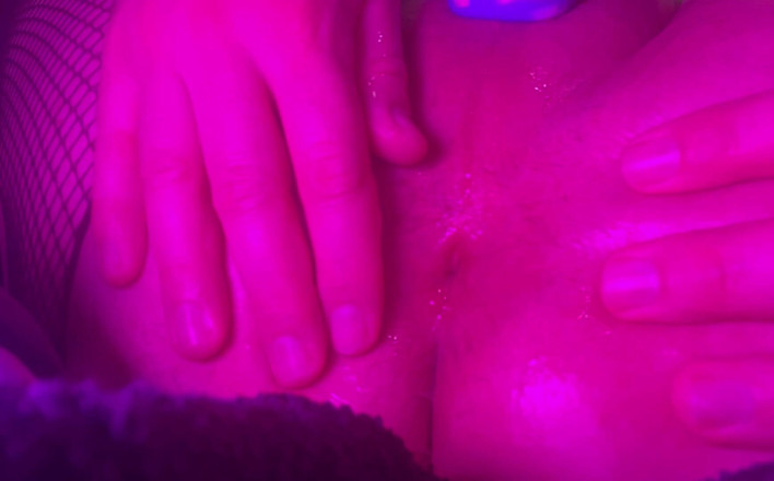 Solodu35x: Dilatace anál