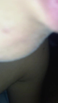 Leche en la boca