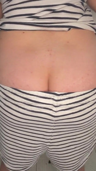 Farting in Pajamas Buttcrack