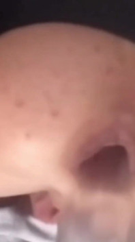 Anal Tears Part Three