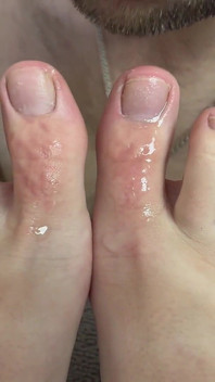 Sloppy Chewing of My Toes