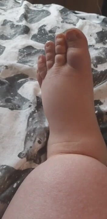 SSBBWLadyBrads: Tlusté baculaté nohy