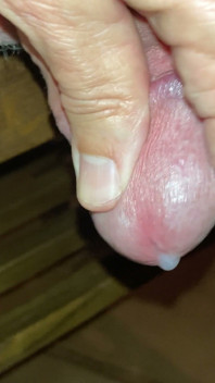 肿胀的头极端特写射液