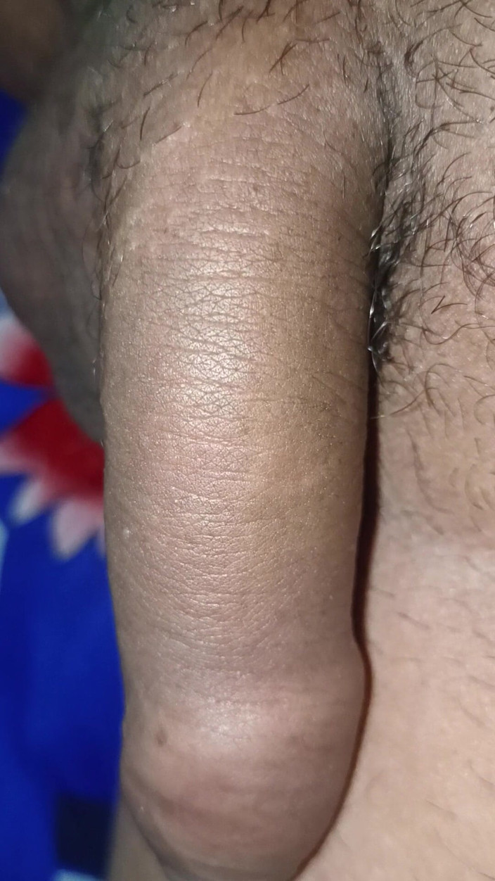 Xada_Nepali: Người trồng nghiệp dư tuyệt vời: xem con cu của...