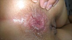 Helena Moeller: Sgrillettamento anale estremo prolasso di 30 minuti