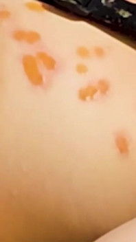 Bound Punk Shaved Head Teen Get Hot Wax Back and Front