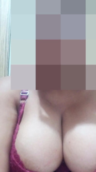 A Chubby Body and Fatal Curves