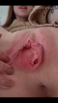 This Hole Needs Your Attention!