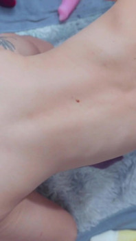 후장 벌리기 후장 피스팅 후장 플러그
