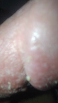 Smegma Big Uncut Smell