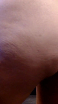 Cellulite-pressen
