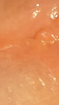 Super Glue on the Glans in the Bathroom at Work.