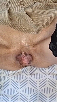 18 anos fisting uma pequena, esticando sua buceta