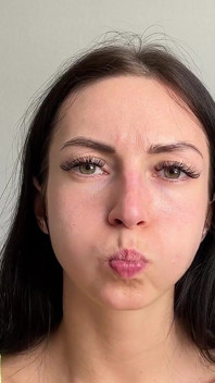 Puffy Cheeks Popping