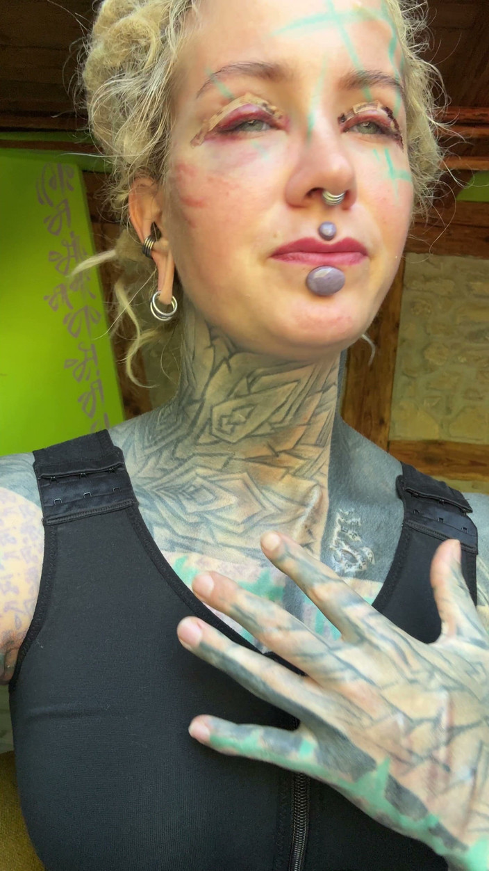 Anuskatzz: Giorno 3 dopo le mie tette e la Blephoplasty alta op