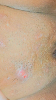 Desi bella ragazza stretta prima volta xxx video di sesso
