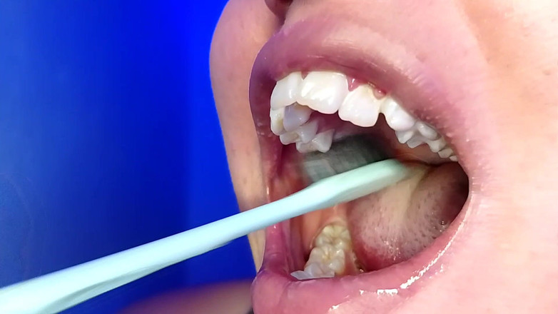 Elimoon: Menghisap gigi saya dan menunjukkan awak gigi saya (rakaman dekat)