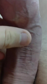 Big Uncut Tight Forskin Cock - Phimosis, Short Cock Play